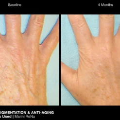 Jan Marini ReNu Corrective Hand Complex -Exclusive Beauty Shop jan marini renu corrective hand complex jan marini shop at exclusive beauty club 458517