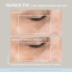 NuFACE FIX KIT -Exclusive Beauty Shop nuface fix kit nuface shop at exclusive beauty club 428594